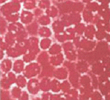 足つぼマッサージする前の赤血球