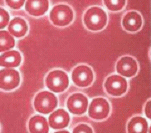 足つぼマッサージ施術後の赤血球